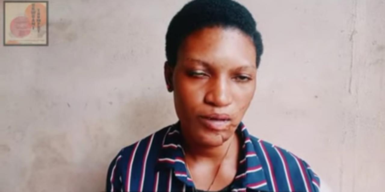 Lady narrates how her mother allegedly chopped off her hand and slashed her face with a machete (photos)