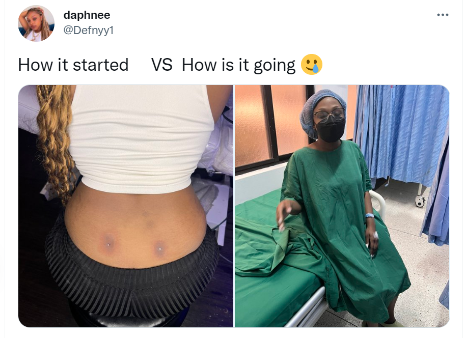 Lady lands in the hospital after getting a back dimple piercing 